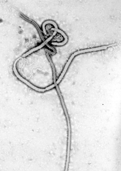 Electron micrograph of the Ebola virus, captured in 1976. For the first time, anyone with a computer or Android-based mobile device can help scientists search for an Ebola cure. A safe and free app from IBM's World Community Grid (www.worldcommunitygrid.org) puts the devices to work when the machines would otherwise be idle. With their collective processing power, the computers will form a virtual supercomputer to help The Scripps Research Institute screen millions of chemical compounds to identify new drug leads for treating Ebola. An effective treatment has thus far proved elusive because of scant resources previously brought to bear, and because the a protein in the virus responsible for replicating itself adopts different shapes for different functions. (Image credit: Dr. Frederick Murphy, Source: Commons. Wikimedia)