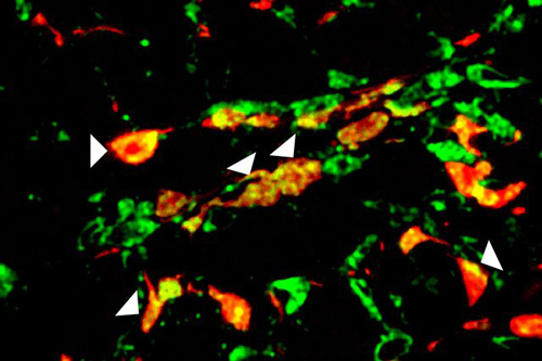 Scar-forming cells (in red) in a region of the injured heart expressing endothelial marker in green and thus appearing yellow (indicated by arrows). Image credit: UCLA