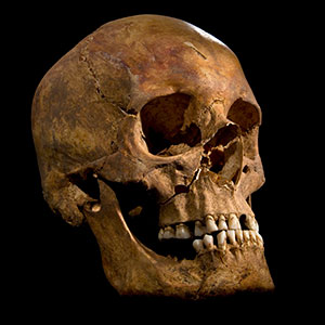 Skull of ‘Skeleton 1’ (Image courtesy of University of Leicester) 