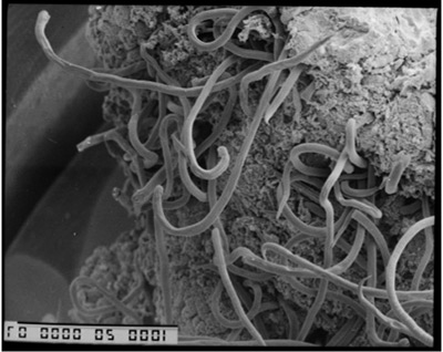 The researchers examined the relationship between each sheep's body weight and its level of infection by nematodes, tiny parasitic worms that thrive in the gastrointestinal tract of sheep. This scanning electron micrograph shows nematodes on the surface of a sheep's gut with a field of view of approximately one centimeter. An economic detriment to sheep farmers, nematodes infect both wild and domesticated sheep, resulting in weight loss, reduced wool growth and death. (Photo by David Smith, Moredun Research Institute)