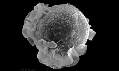 An Epstein-Barr virus erupting from an infected immune cell, called a B lymphocyte. Image credit: Analytical Imaging Facility at the Albert Einstein College of Medicine.