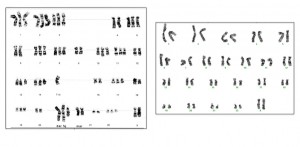 The left image shows the chromosomes of an immortal cell line derived by treatment with a chemical carcinogen. It has an aberrant number and arrangement of chromosomes. This line had to generate the errors that allowed immortalization. The right image shows the chromosomes of an immortal line derived using the new Berkeley Lab method. It has the normal number of 46 chromosomes arranged in 23 pairs. Because of their normal karyotype, these new immortal cell lines may help scientists better understand cell immortalization as it occurs in people. Image credit: Karen Swisshelm, left image; Arthur Brothman and Laura Fuch, right image (Click image to enlarge)