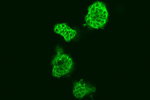 Zellen der kolorektalen Tumorzelllinie Colo-205. Nach einer Behandlung mit dem B-Raf-Hemmer PLX4720 formen diese Zellen kompakte Strukturen mit einem hohen Anteil des Zelladhäsionsmoleküls E-cadherin (grün). Image Quelle: Ricarda Herr/AG Brummer