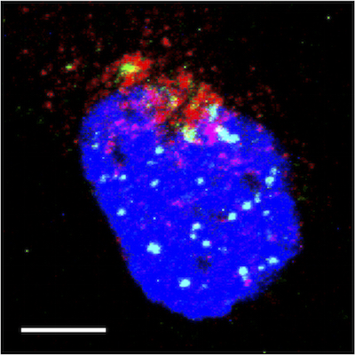 Confocal microscopic image of a labeled HPV genome infecting a cell: During infection, the virus takes hijacks the cell's Golgi apparatus (red) - a cell's equivalent of a courier service - to distribute the viral genome (green) throughout the cell nucleus (blue). (Image credit: Samuel Campos)