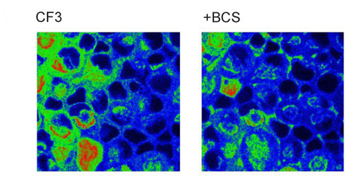 Two-photon imaging of CF3 shows that the addition of acute BCS dosages also reduces labile copper pools in retinal neurons. Image credit: Berkeley Lab