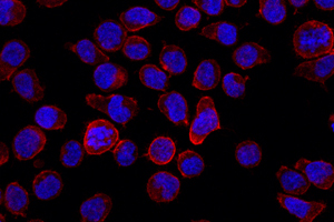 Zellen aus einem B-Zell-Tumor. Foto credit: Arbeitsgruppe Reth/Universität Freiburg