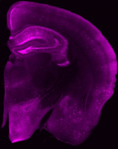 Blick ins Gehirn einer Maus: In den magenta leuchtenden Bereichen haben sich Tau-Proteine angesammelt. In einigen Nervenzellen (helle Flecken) ist die Konzentration besonders hoch. Zum Teil sind die Fortsätze (Dendriten) der Nervenzellen zu erkennen. Image credit: © Jens Wagner / DZNE 