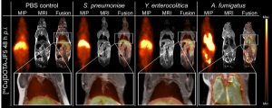 Rechts eine Mäuselunge, deren Befall mit dem Schimmelpilz A. fumigatus durch die Anreicherung der radioaktiv markierten Antikörper (helle Bereiche) sichtbar wird, wohingegen eine mit dem bakteriellen Erreger Yersinia enterocolitica infizierte Lunge (links) keinerlei Anreicherung im Lungengewebe zeigt. Grafik credit: Werner Siemens Imaging Center (Click image to enlarge)