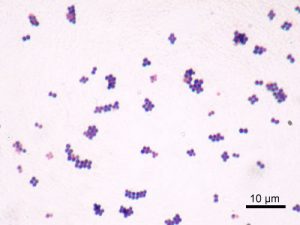 Microscopic image of Staphylococcus aureus (ATCC 25923). Gram staining, magnification:1,000. Image credit: Y Tambe Source: Wikipedia)