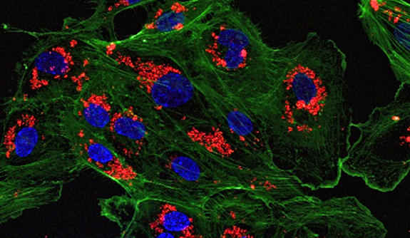 A microscopic image of endothelial cells treated with drug-loaded nanoparticles. (Image courtesy of the Saltzman Lab) 