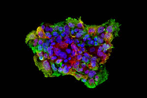 Brustkrebsstammzelllinie 1 aus dem neu etablierten Zellmodell. Dargestellt sind die Proteine Keratin 5 in grün und Keratin 8 in rot sowie die Zellkerne in blau. Bild Quelle: Maurer Lab 
