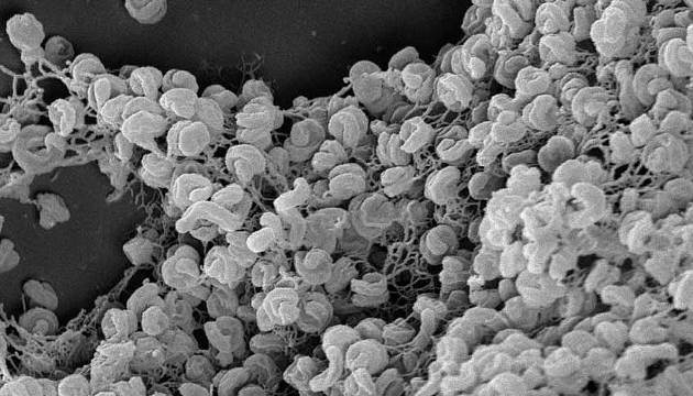 Elektronenmikroskopische Aufnahme eines Zell-Aggregats von Comammox-Bakterien der Art Nitrospira inopinata. Die spiralförmig gewundene Gestalt der Zellen ist gut erkennbar. Die Zellen haben einen Durchmesser von etwa 0,3 Mikrometer und sind bis zu 1,7 Mikrometer lang (Image copyright: Anne Daebeler und Stefano Romano). 