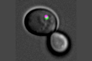 In einer Hefezelle wird der Zellabfall (magentafarben) von Autophagosomenmembranen (grün) eingehüllt. Bild Quelle: Claudine Kraft 