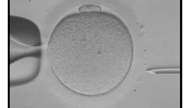 WissenschafterInnen von der Universität Wien haben eine neue Theorie entwickelt, warum die Menopause existiert. Image credit: Dovidena (Source: Wikimedia Commons).