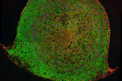 Immunfluoreszenzfärbung von Matrixproteinen in technisiertem Knorpel. Bild Quelle: Institut für Makromolekulare Chemie 